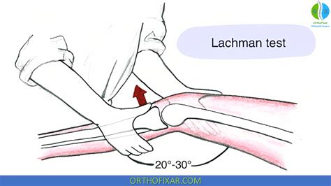 lachman anterior drawer test results